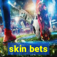 skin bets