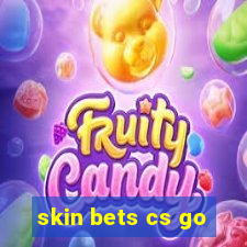 skin bets cs go