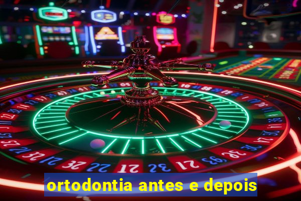 ortodontia antes e depois